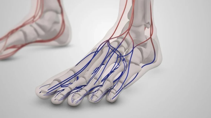 Reversing Foot and Leg Pain with Nerve Decompression Surgery