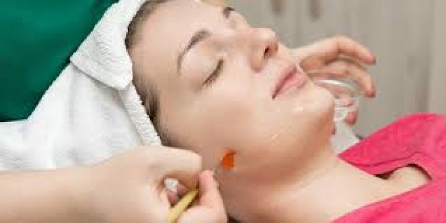 Which Is Better, Carbon Laser or Chemical Peeling for Skin Reboot