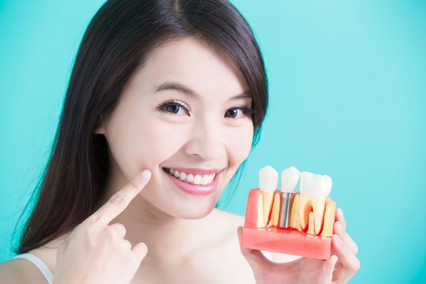 Dental Implants: Aftercare Tips That Matter