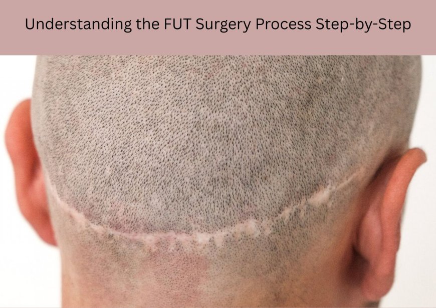 Understanding the FUT Surgery Process Step-by-Step