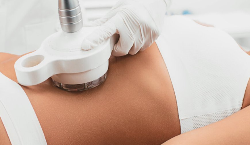 Fat Freezing for Double Chin: Target Fat Easily
