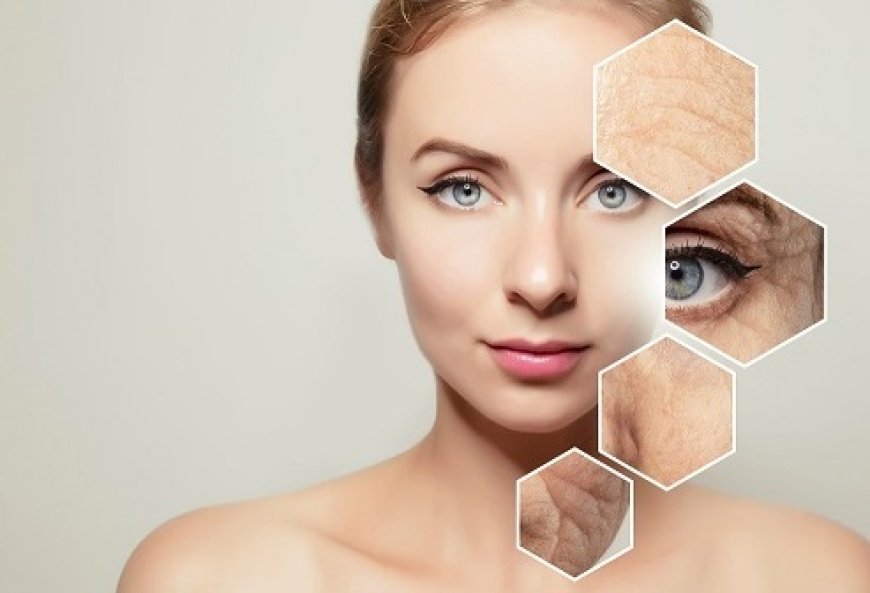 Acne Scar Treatment and the Role of Nutrition