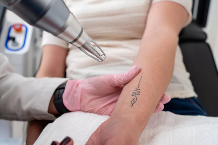 Laser Tattoo Removal for Different Skin Tones: What You Need to Know