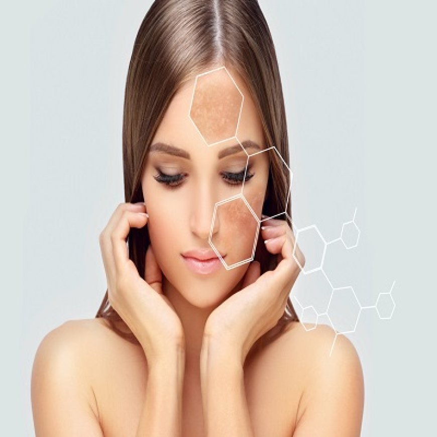 Can melasma treatment cause skin irritation or redness?