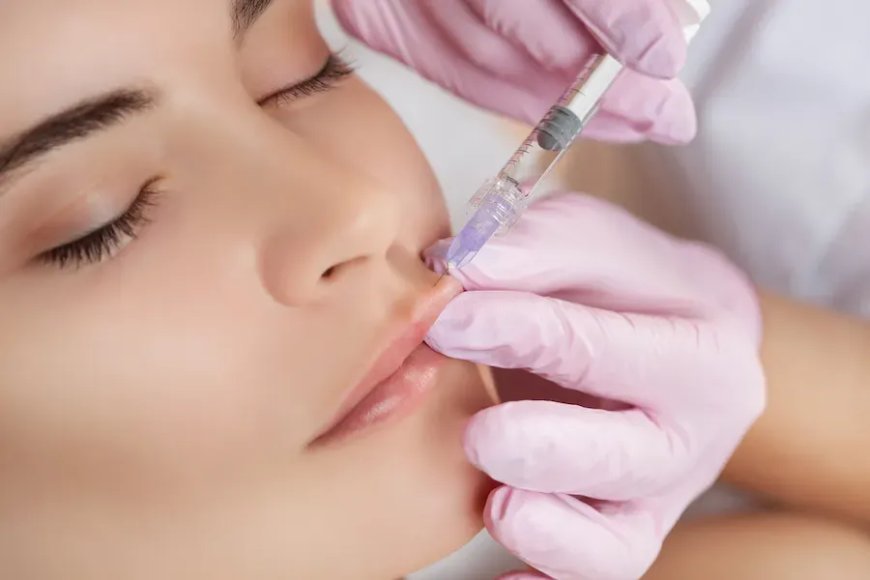 Why the Russian Lip Look Is Dominating the Beauty Scene