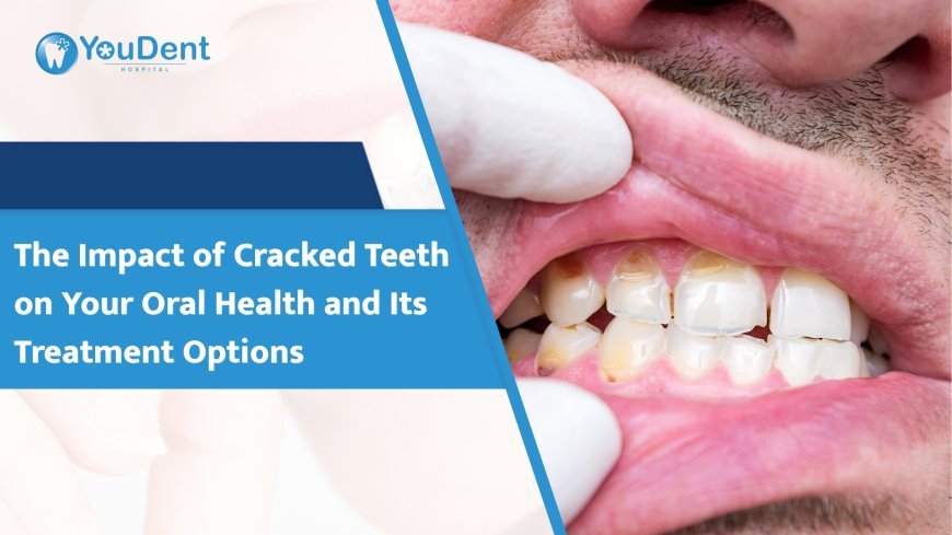 The Impact of Cracked Teeth on Your Oral Health and Its Treatment Options