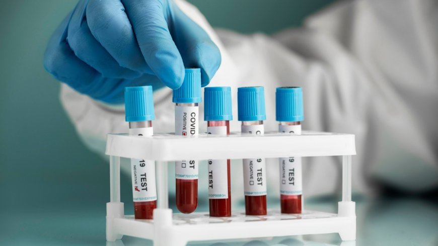 Home Blood Test Bangalore - Convenient Health Monitoring at Your Doorstep