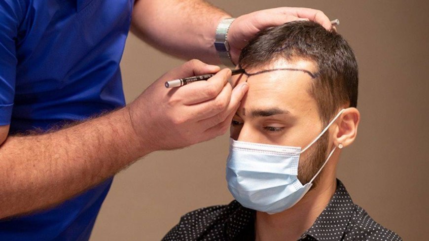 What to Avoid Before Hair Transplant Surgery