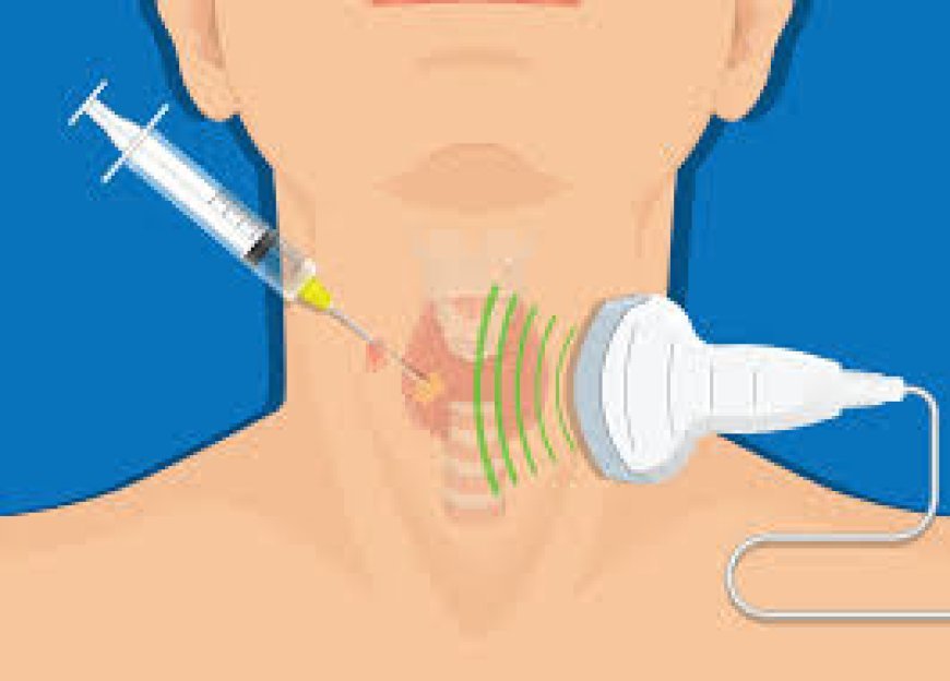 Expert Thyroid Care: A Closer Look at Dr. Stan Sidhu’s Surgical Excellence