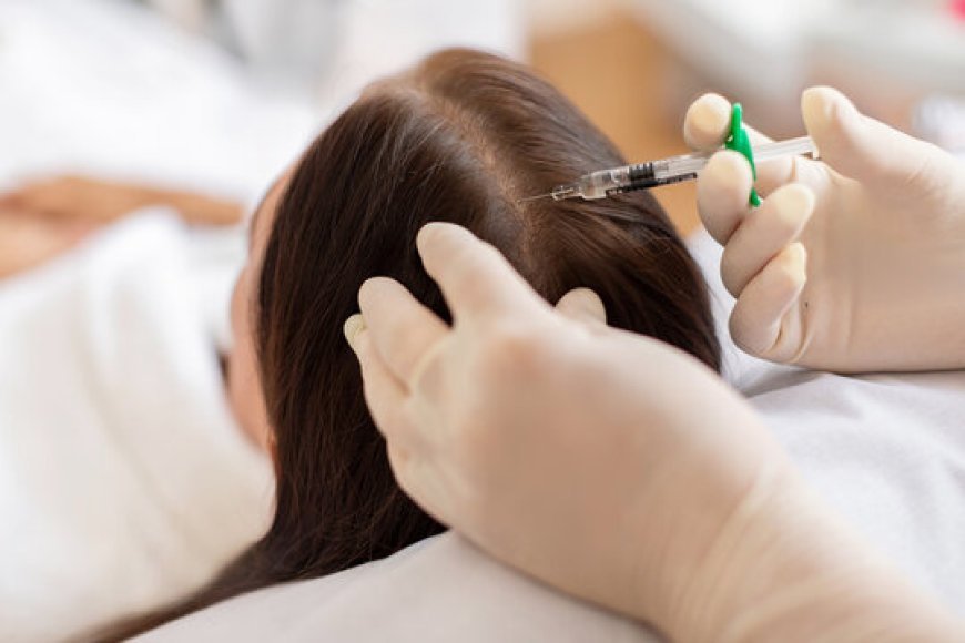 PRP Hair Restoration for Women: Is It Effective?