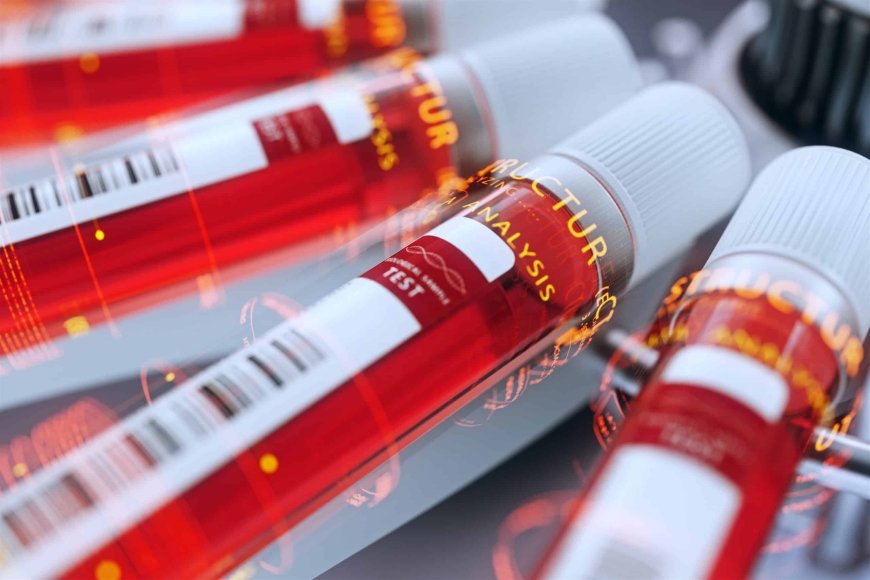 Detect Deficiencies with Blood Tests for Body Analysis