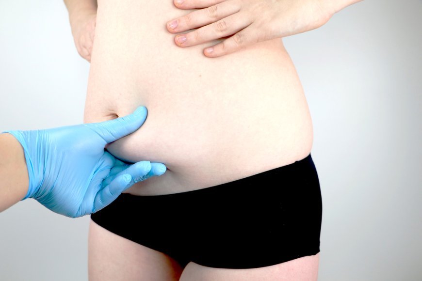 Fat Transfer Surgery: Latest Advances Explained