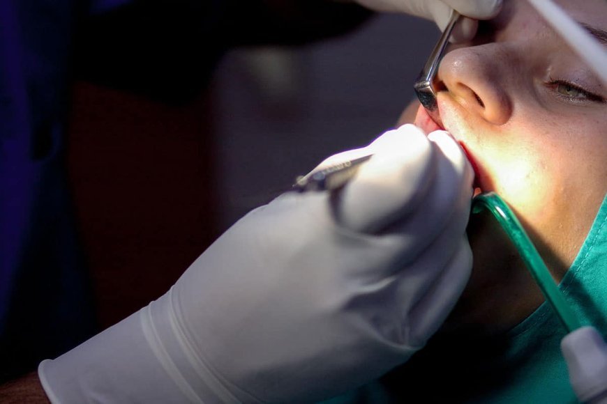 Questions to Ask Your Dentist Before Getting a Root Canal