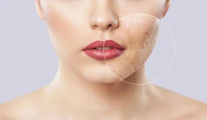 علاج سهل منزلي الصنع للمسام الواسعة يمكنك تجربته