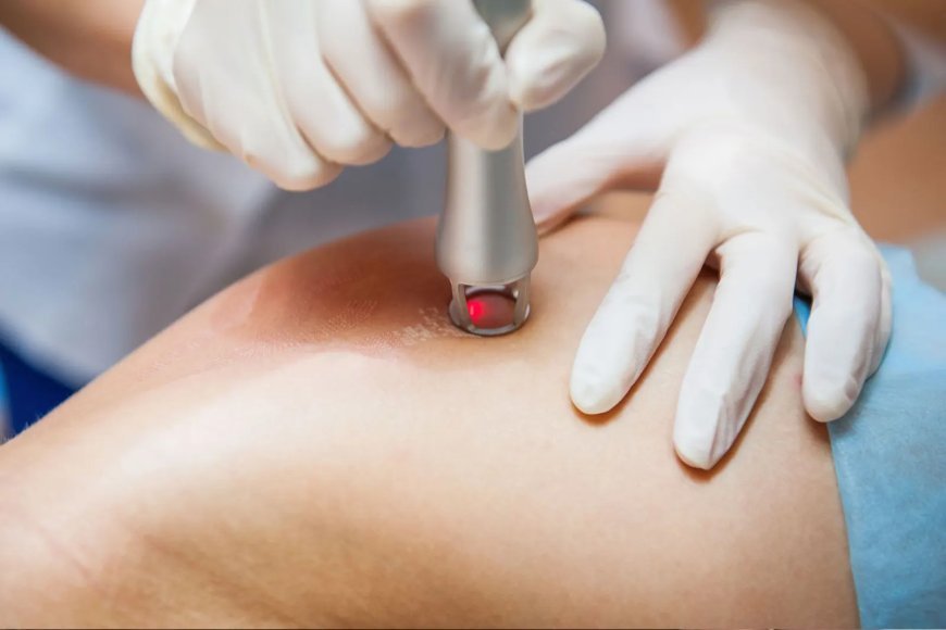 Foods to Support Healing After Scar Laser Treatment