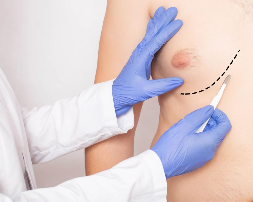 Hormonal Imbalance and Gynecomastia – What Are the Links?