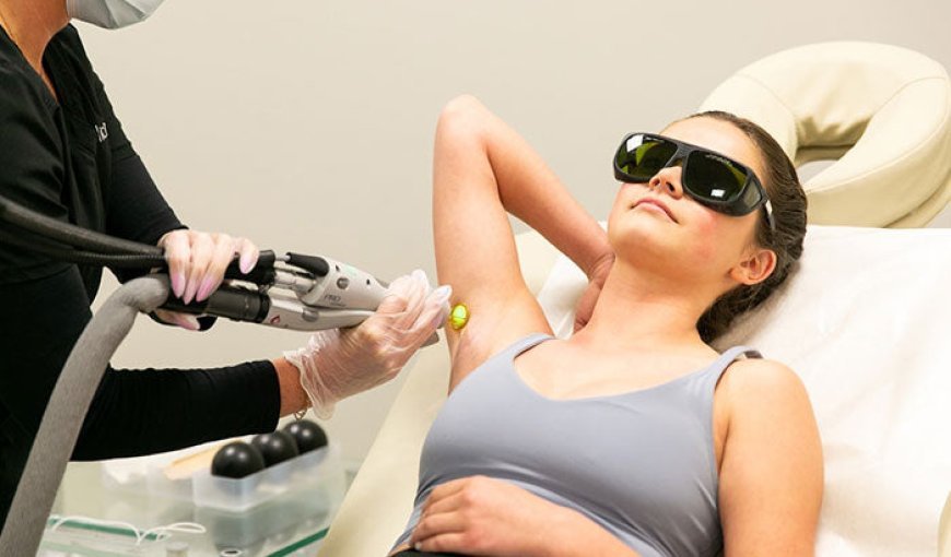 Laser Hair Removal: Results After Just One Visit