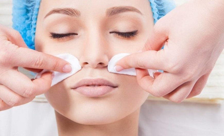 Preparing Your Skin for Chemical Peels at Home