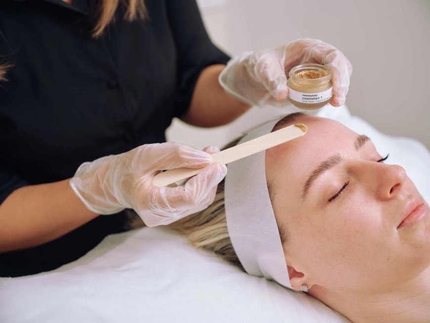 Discover Brighter Skin with Cosmelan Peel Now