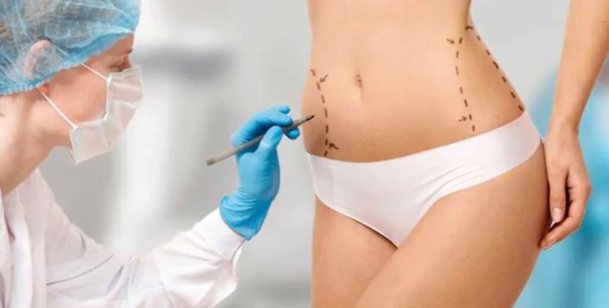 Liposuction in Islamabad: What You Need to Know