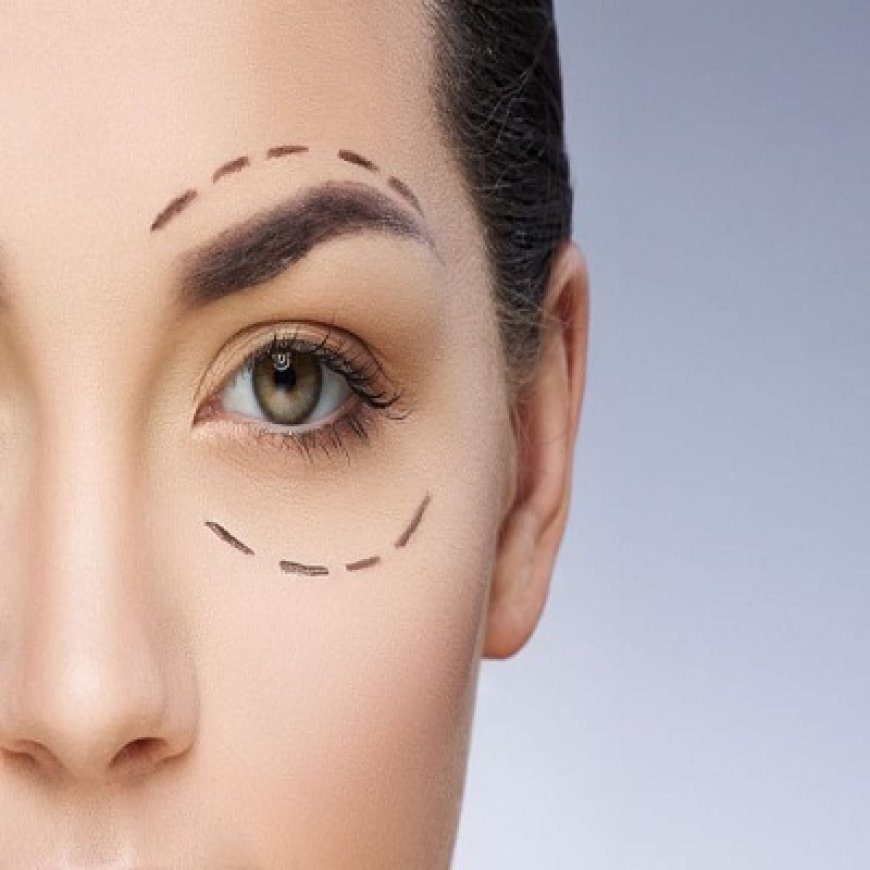 Eyelid Surgery Recovery in Islamabad: Tips for a Smooth Healing Process
