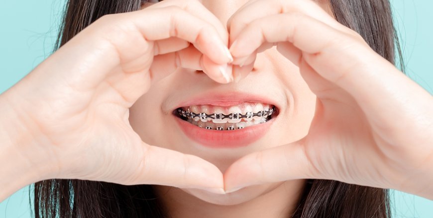 Getting Braces in Islamabad: A Step-by-Step Process