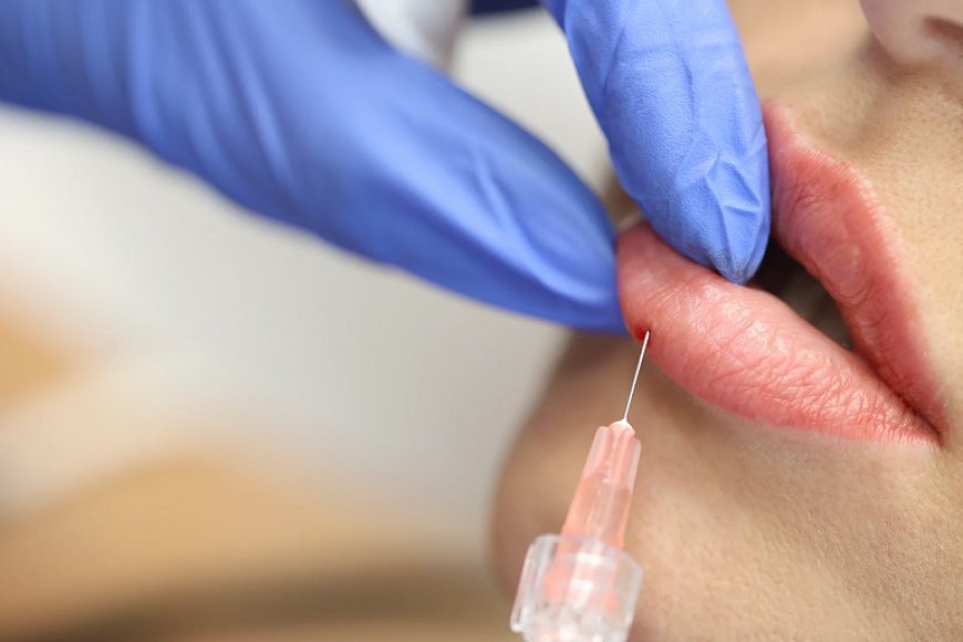 Lip Botox Treatment Time and Recovery Facts
