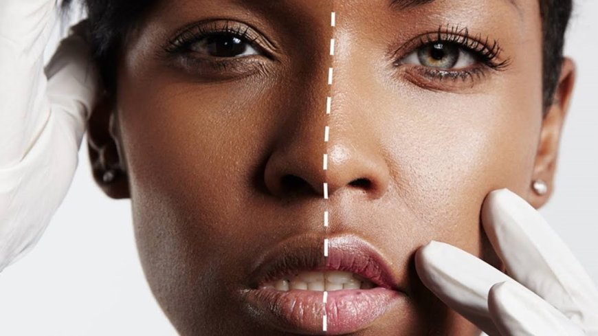 Side Effects of Skin Whitening in Islamabad – and How to Prevent Them
