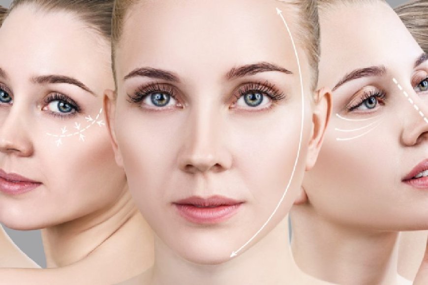 Fotona 4D Facelift Treatment: Laser Facelift That Works