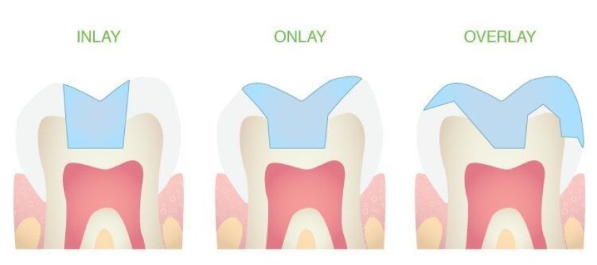 Durable & Natural Smile Restorations in Rochdale