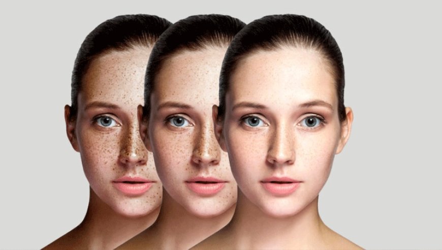 Pigmentation Treatment Non-Invasive Ways to Brighten Skin