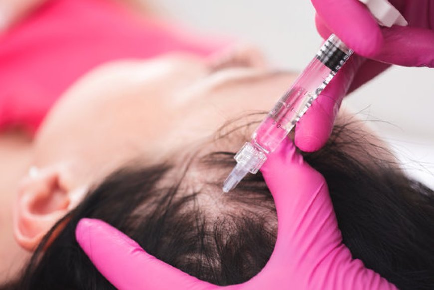 Affordable PRP Scalp Therapy in Islamabad: Top Clinics to Consider