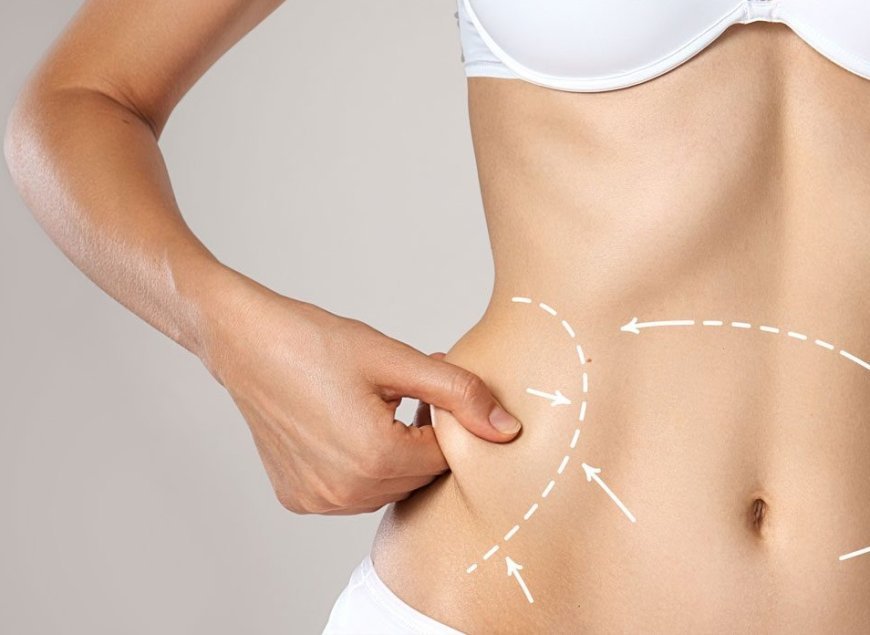 How to Care for Your Incisions Post-Liposuction in Islamabad