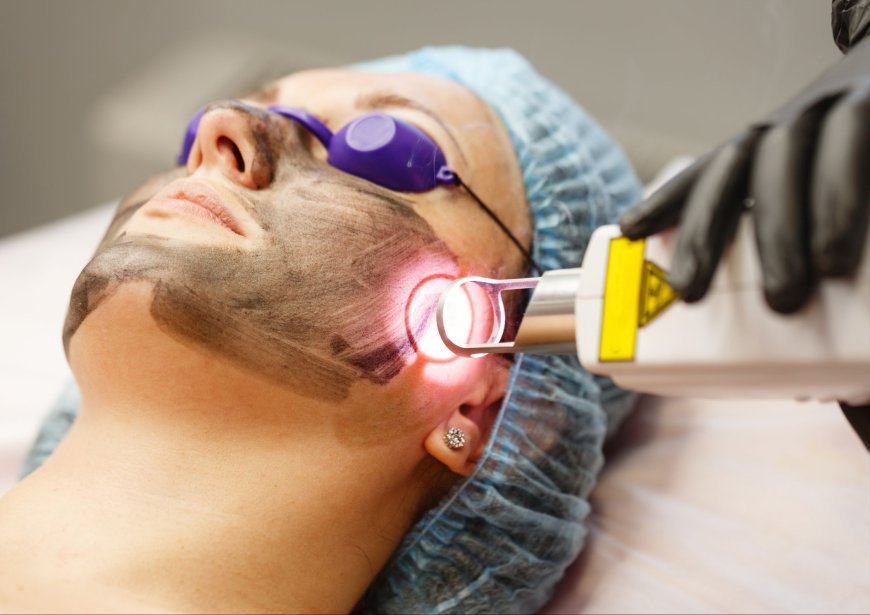 How to Prepare Your Skin Before a PICO Laser Session