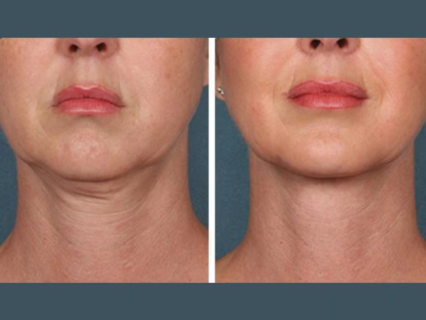 Best Doctors in Dubai for Natural PRP Treatment Healing