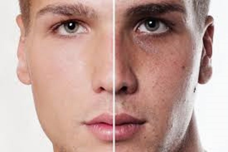Skin Whitening Myths Busted with Real Solutions