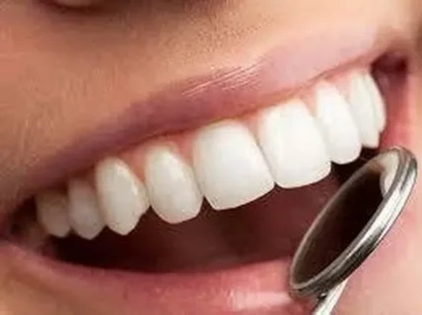 Dental Crown Fixes for Chipped or Cracked Teeth in Islamabad