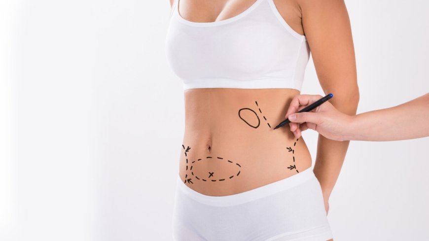 Liposuction in Islamabad: Transforming Your Lifestyle