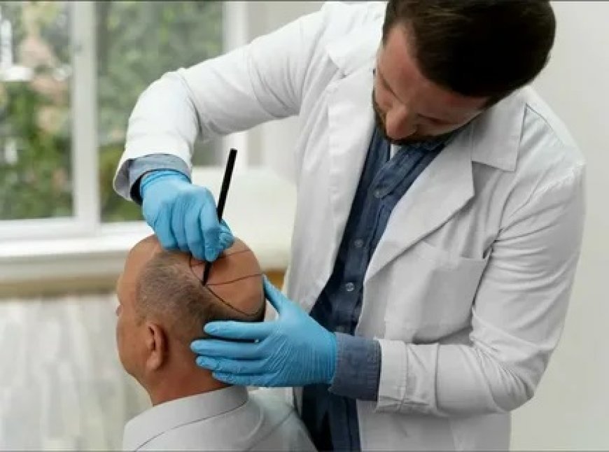 Combining Treatments with Hair Transplant in Islamabad